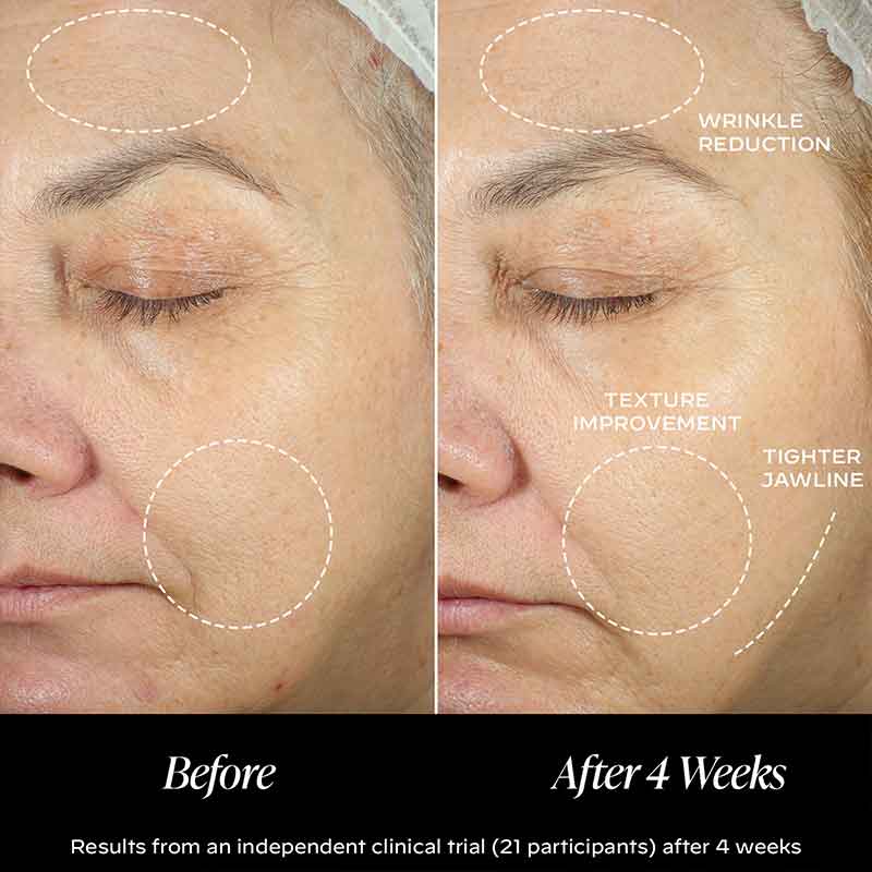 Zelens Peptide Complex Firming Cream Before & After