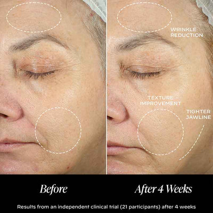 Zelens Peptide Complex Firming Cream Before & After