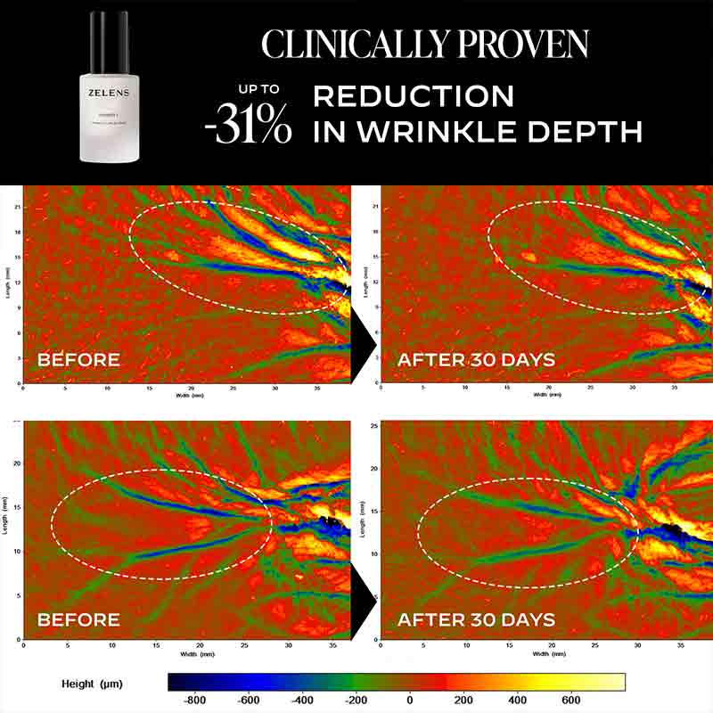 Zelens Power C Serum Before & After Clinical test results