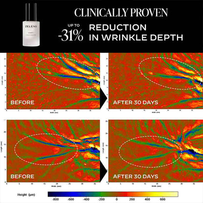 Zelens Power C Serum Before & After Clinical test results
