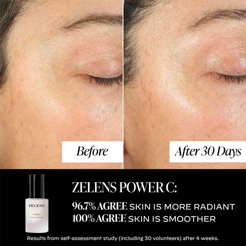 Zelens Power C Serum Before & After