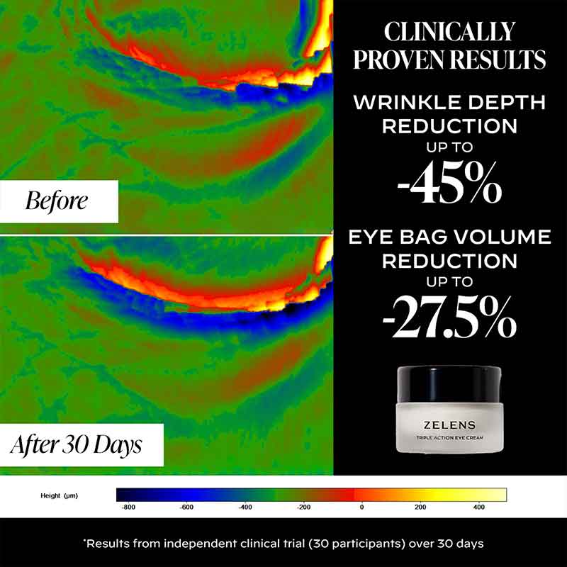 Zelens Triple-Action Eye Cream Clinical Tests