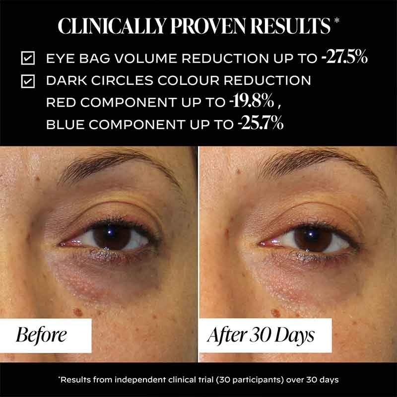 Zelens Triple-Action Eye Cream Before & After