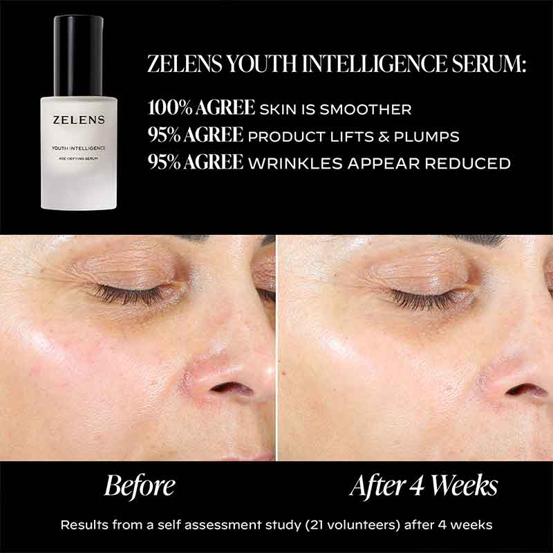 Zelens Youth Intelligence Age-Defying Serum Before & After