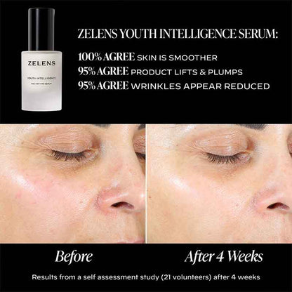 Zelens Youth Intelligence Age-Defying Serum Before & After