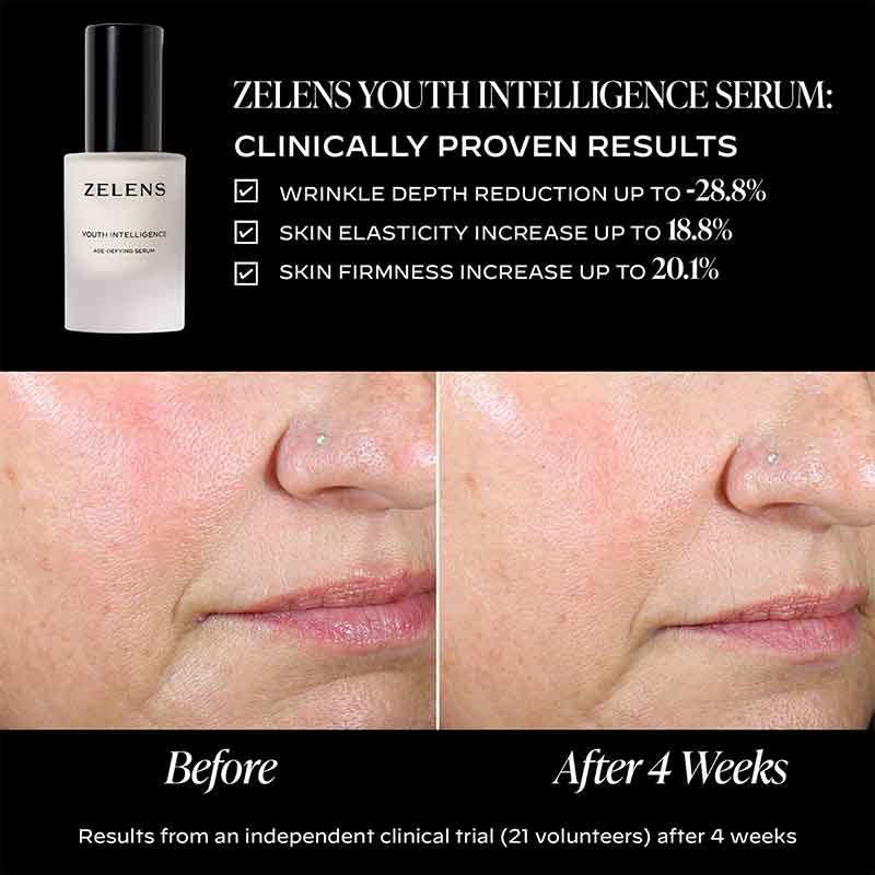 Zelens Youth Intelligence Age-Defying Serum Before & After
