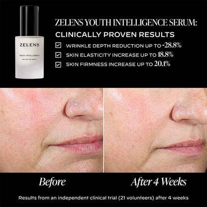 Zelens Youth Intelligence Age-Defying Serum Before & After