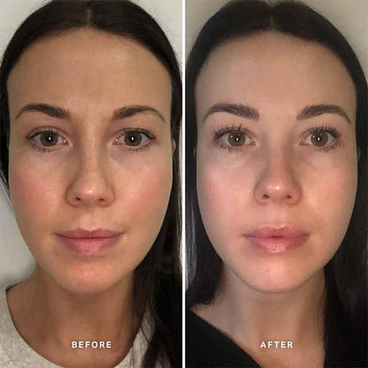 Alpha-H Vitamin B Serum with 5% Niacinamide | before and after using vitamin b serum for 4 weeks 
