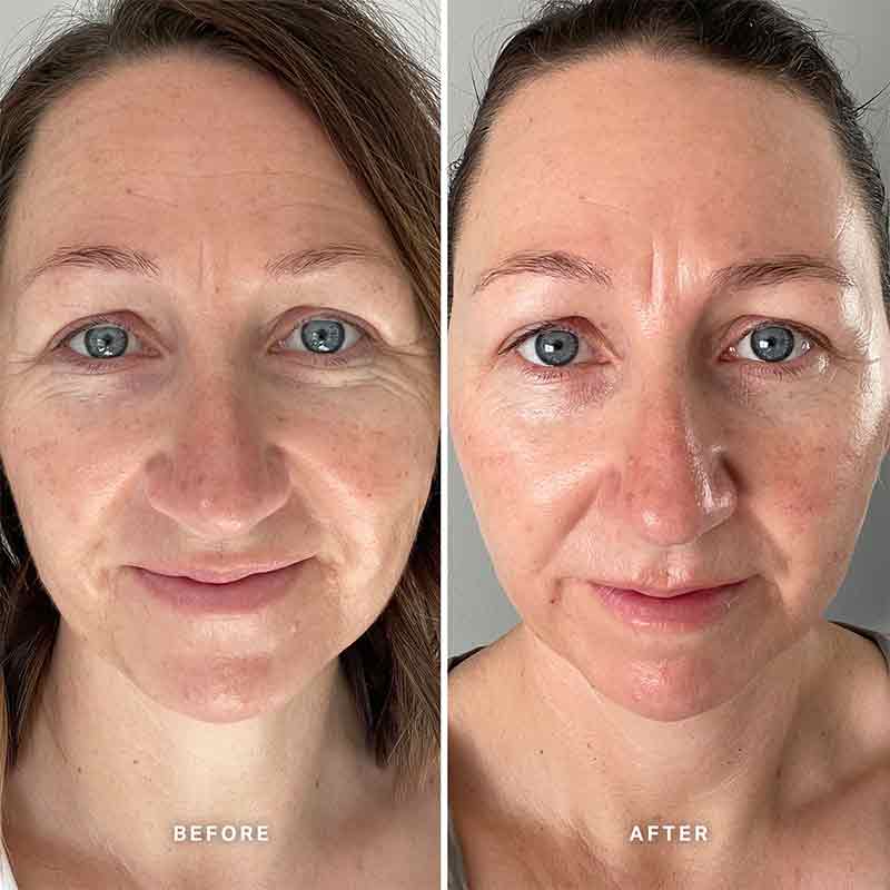 Alpha-H Vitamin E Serum with 1% Ceramide Complex | 4 week trial before and after alpha h