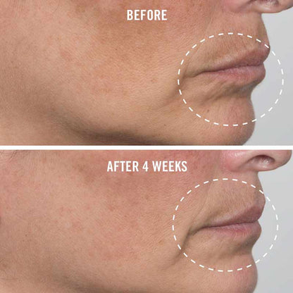First Aid Beauty Ultra Repair Firming Collagen Cream | Antiaging | Collagen | Peptides | Niacinamide | Before and after | Lip Area