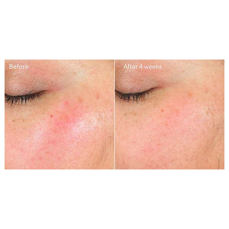 Murad Intense Recovery Cream | before and after