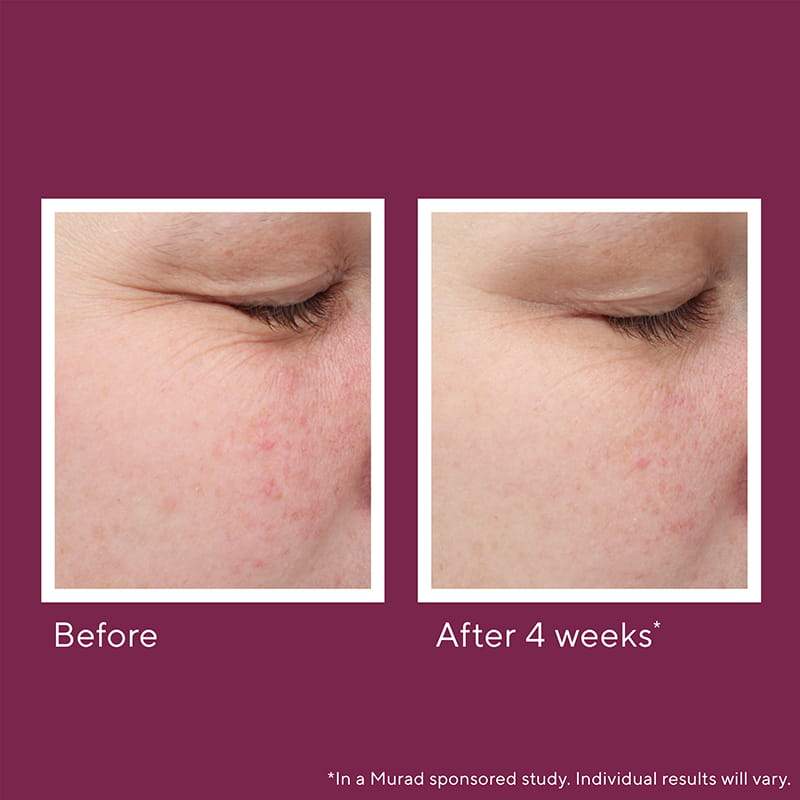 Murad Night Fix Enzyme Treatment | before and after | fine lines