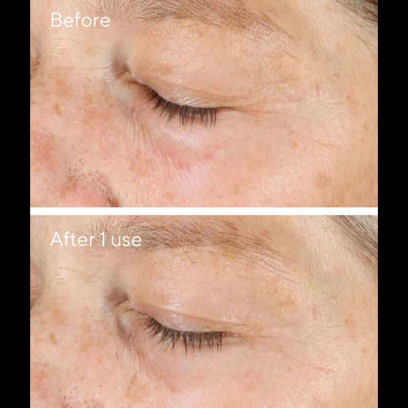 Murad Environmental Shield Vita C Triple Exfoliating Facial  | Murad Before And After | Purify Pores | Brighten Skin