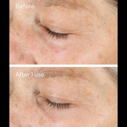 Murad Environmental Shield Vita C Triple Exfoliating Facial  | Murad Before And After | Purify Pores | Brighten Skin