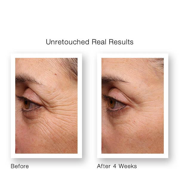 Murad Resurgence Retinol Youth Renewal Eye Serum Before & After | anti wrinkle 