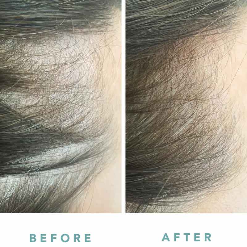 We Are Paradoxx Advanced Scalp Serum | Hydrating hair serum | High-performance ingredients | Healthy hair products | Nourishing hair products | Hair growth