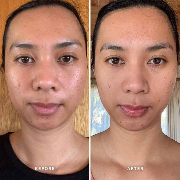 Alpha-H Vitamin C Serum with 10% Ethyl Ascorbic Acid | 4 week trial using vitamin c serum | facial serum vitamin c before and after